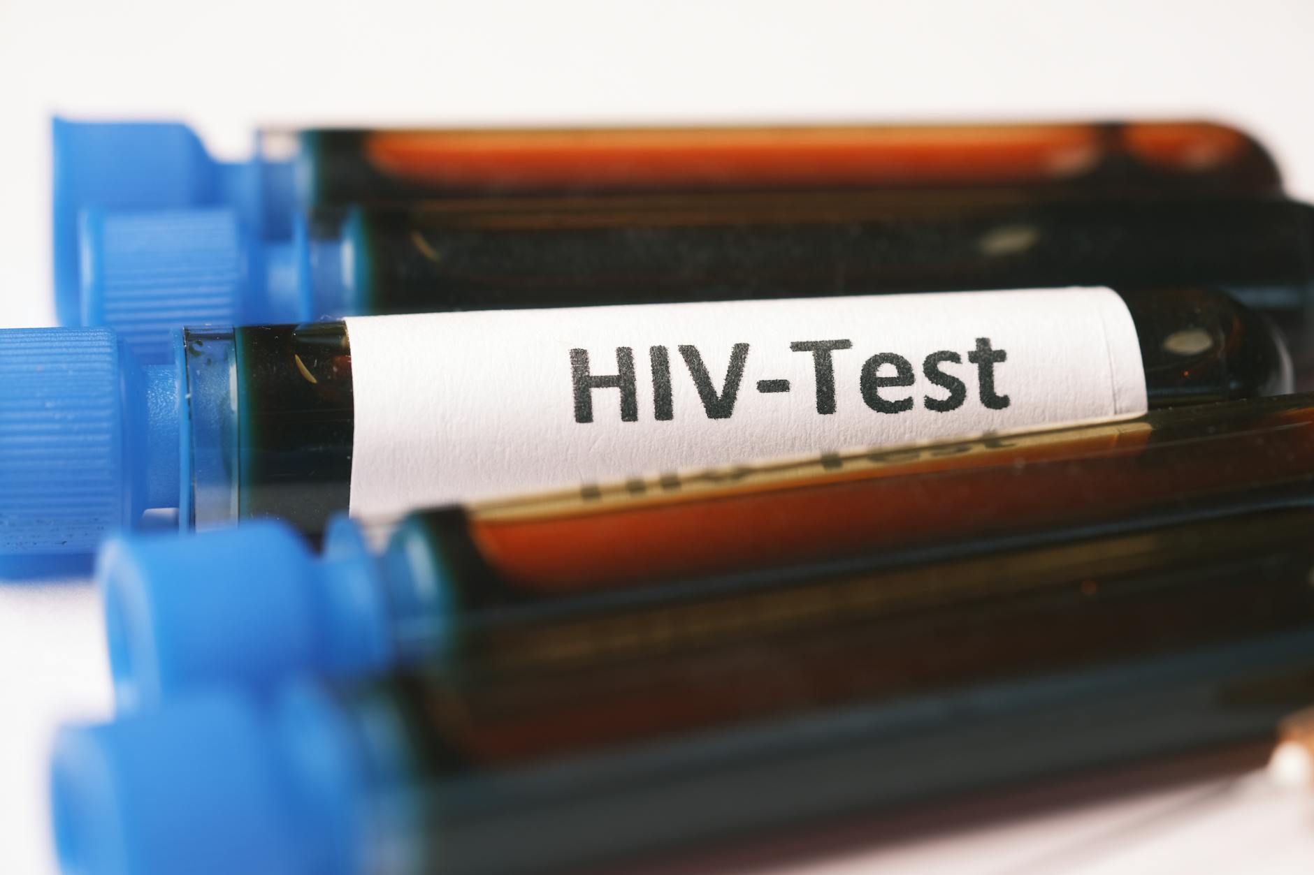 blood samples for hiv test